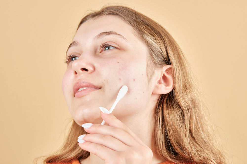 Stress Acne and A Simple Skincare Guide That Works