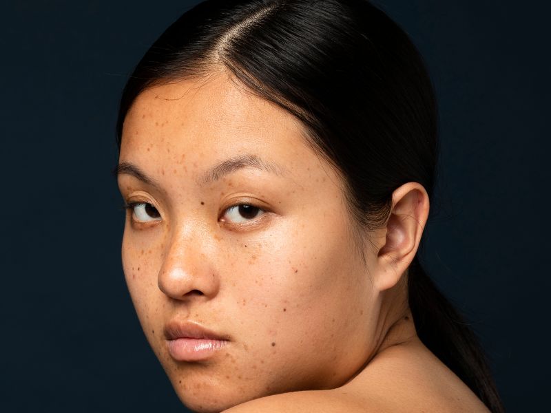 Side view woman with freckles