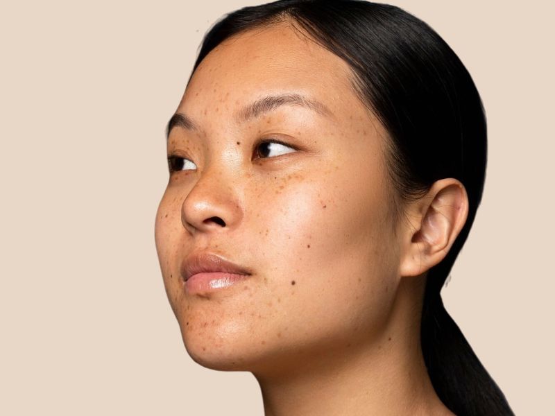 Girl with freckles on her face