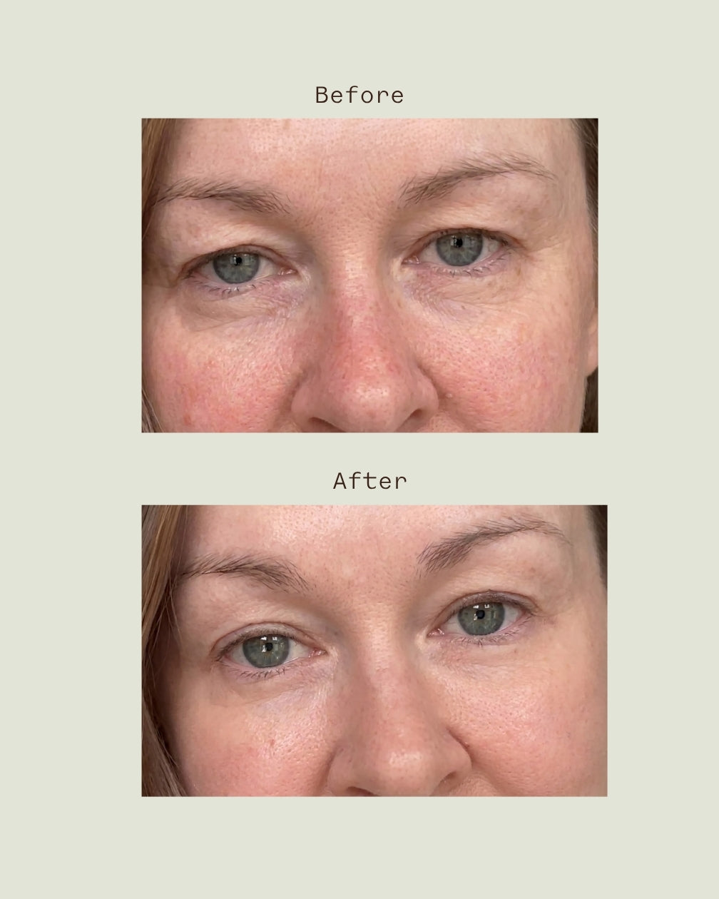 Anti-Fatigue Restorative Eye Cream