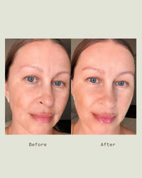 Anti-Stress Renewal Moisturizer